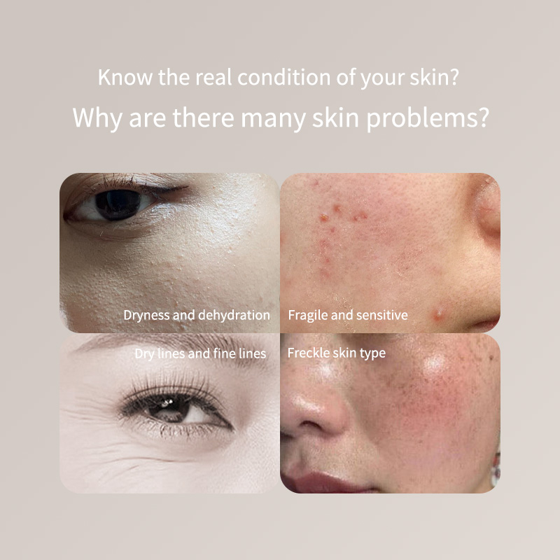 Pena Penguji Kulit Portabel -  - Skincare Only You ulasan dan harga